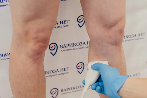 Второе мнение от хирурга- флеболога бесплатно