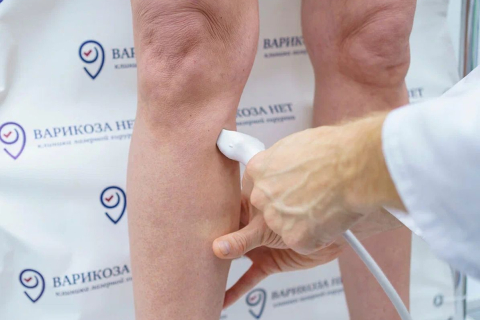 Можно ли определить варикоз по внешнему виду ног
